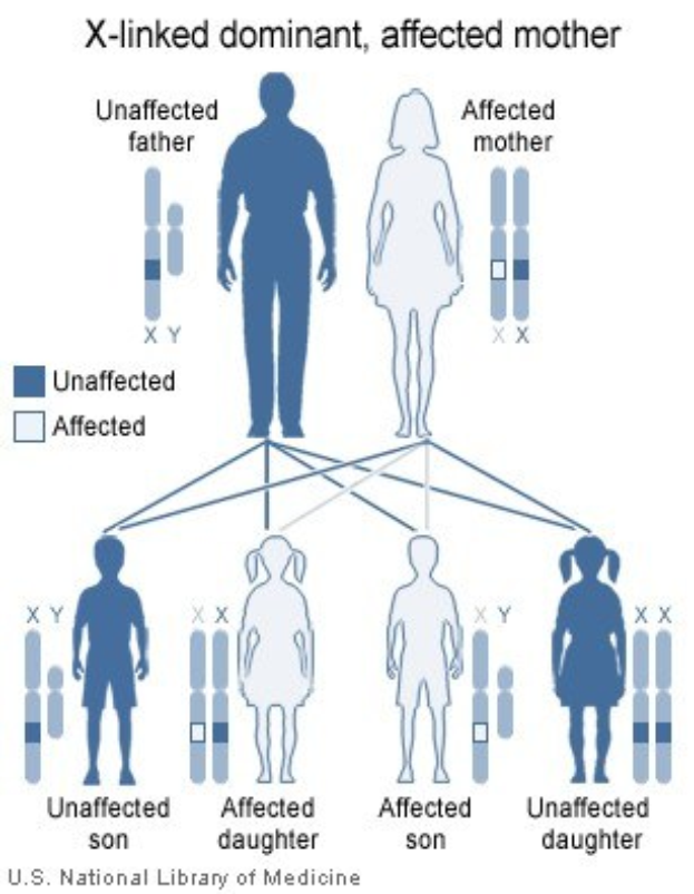 Diagramm eines X-vererbungsdominanten Familienstammbaums mit einer betroffenen Mutter und begleitendem erklärendem Text.